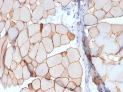 Immunohistochemistry-Paraffin: Dystrophin Antibody (DMD/3241) [NBP2-79776]