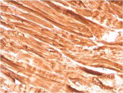 Immunohistochemistry-Paraffin: Dystrophin Antibody (DMD/3242) - Azide and BSA Free [NBP2-79917]
