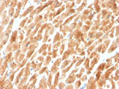 Immunohistochemistry-Paraffin: Dystrophin Antibody (DMD/3242) - Azide and BSA Free [NBP2-79917]
