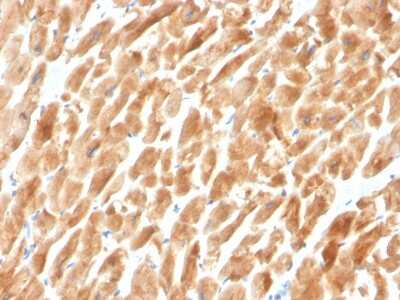 Immunohistochemistry-Paraffin: Dystrophin Antibody (DMD/3242) - Azide and BSA Free [NBP2-79917]