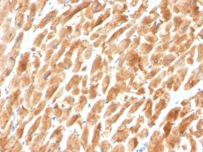 Immunohistochemistry-Paraffin: Dystrophin Antibody (DMD/3242) [NBP2-79783]