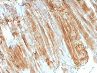 Immunohistochemistry-Paraffin: Dystrophin Antibody (DMD/3243) [NBP3-07641]