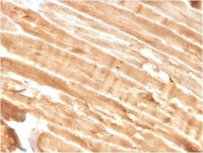 Immunohistochemistry-Paraffin: Dystrophin Antibody (DMD/3244) [NBP3-07653]