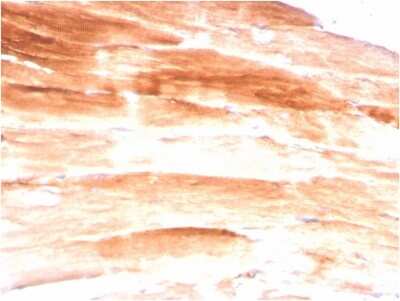 Immunohistochemistry-Paraffin: Dystrophin Antibody (DMD/3245) [NBP3-07654]