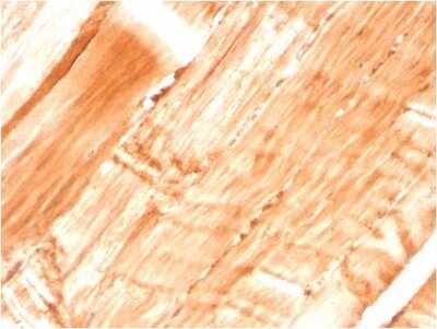 Immunohistochemistry-Paraffin: Dystrophin Antibody (DMD/3677) - Azide and BSA Free [NBP3-08707]