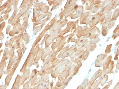 Immunohistochemistry-Paraffin: Dystrophin Antibody (DMD/3677) - Azide and BSA Free [NBP3-08707]