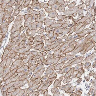 Immunohistochemistry-Paraffin: Dystrophin Antibody [NBP1-89953]