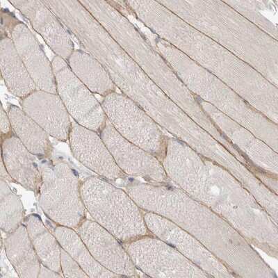Immunohistochemistry-Paraffin: Dystrophin Antibody [NBP1-89953]