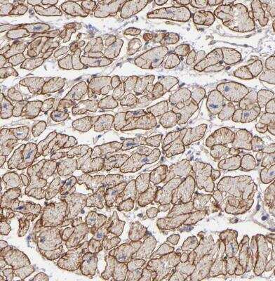 Immunohistochemistry-Paraffin: Dystrophin Antibody [NBP1-89954]