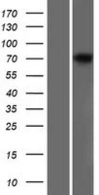 Western Blot: Dystrophin Overexpression Lysate [NBP2-10564]