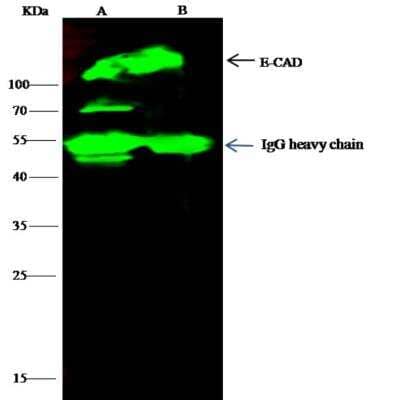 Immunoprecipitation: E-Cadherin Antibody (056) [NBP2-89338]