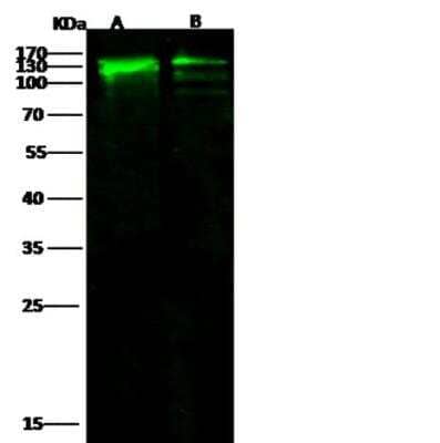 Western Blot: E-Cadherin Antibody (056) [NBP2-89338]