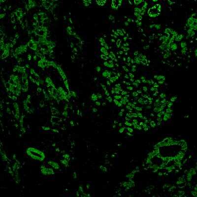 Immunohistochemistry: E-Cadherin Antibody (4A2) - Azide and BSA Free [NBP2-54587]