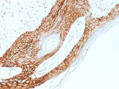 Immunohistochemistry-Paraffin: E-Cadherin Antibody (4A2) - Azide and BSA Free [NBP2-54587]