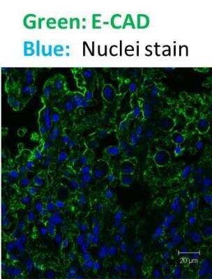 Immunocytochemistry/ Immunofluorescence: E-Cadherin Antibody (7H12) - BSA Free [NBP2-19051]