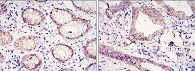 Immunohistochemistry-Paraffin: E-Cadherin Antibody (7H12) - BSA Free [NBP2-19051]