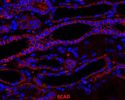 Immunohistochemistry-Paraffin: E-Cadherin Antibody (7H12) - BSA Free [NBP2-19051]