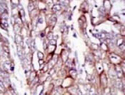 Immunohistochemistry-Paraffin: E-Cadherin Antibody (7H12) - BSA Free [NBP2-19051]