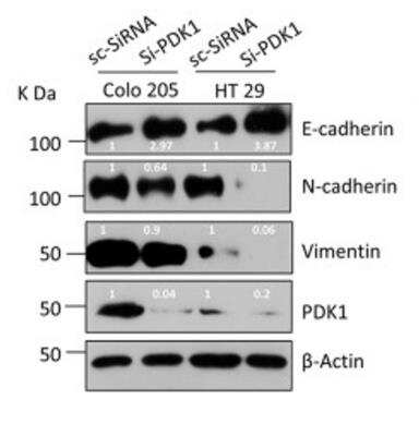Western Blot: E-Cadherin Antibody (7H12)BSA Free [NBP2-19051]