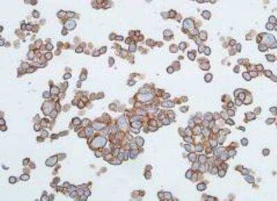 Immunocytochemistry/ Immunofluorescence: E-Cadherin Antibody (BLR088G) [NBP3-14687]