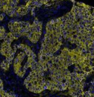 Immunocytochemistry/ Immunofluorescence: E-Cadherin Antibody (BLR088G) [NBP3-14687]