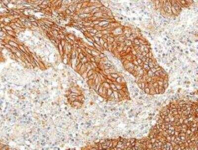 Immunohistochemistry-Paraffin: E-Cadherin Antibody (BLR088G) [NBP3-14687]