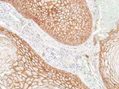 Immunohistochemistry-Paraffin: E-Cadherin Antibody (BLR088G) [NBP3-14687]