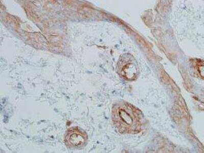 Immunohistochemistry-Paraffin: E-Cadherin Antibody (BLR088G) [NBP3-14687]