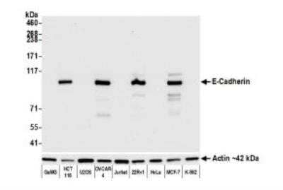 Western Blot: E-Cadherin Antibody (BLR088G) [NBP3-14687]