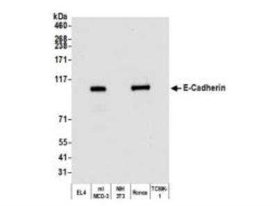 Western Blot: E-Cadherin Antibody (BLR088G) [NBP3-14687]