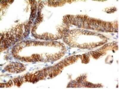 Immunohistochemistry-Paraffin: E-Cadherin Antibody (CDH1/1525) - Azide and BSA Free [NBP2-54551]