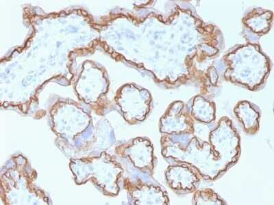 Immunohistochemistry-Paraffin: E-Cadherin Antibody (CDH1/1525) - Azide and BSA Free [NBP2-54551]