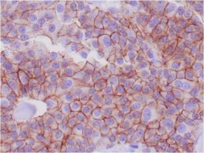 Immunohistochemistry-Paraffin: E-Cadherin Antibody (CDH1/1525) - Azide and BSA Free [NBP2-54551]