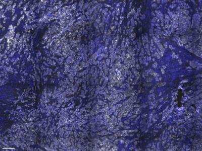 Immunohistochemistry-Paraffin: E-Cadherin Antibody (CDH1/1525) - Azide and BSA Free [NBP2-54551]