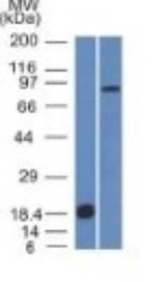 Western Blot: E-Cadherin Antibody (CDH1/1525)Azide and BSA Free [NBP2-54551]