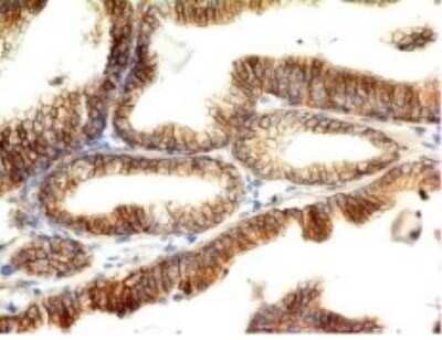 Immunohistochemistry-Paraffin: E-Cadherin Antibody (CDH1/1525) [NBP2-53354]