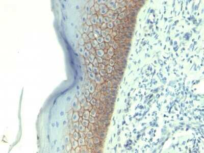 Immunohistochemistry-Paraffin: E-Cadherin Antibody (CDH1/1525) [NBP2-53354]
