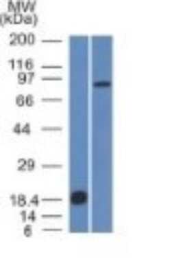 Western Blot: E-Cadherin Antibody (CDH1/1525) [NBP2-53354]