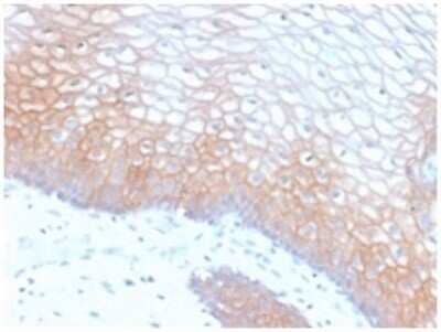 Immunohistochemistry-Paraffin: E-Cadherin Antibody (CDH1/2208R) [NBP3-07902]
