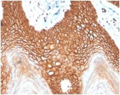 Immunohistochemistry-Paraffin: E-Cadherin Antibody (CDH1/4398R) - Azide and BSA Free [NBP3-09082]