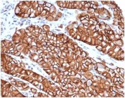 Immunohistochemistry-Paraffin: E-Cadherin Antibody (CDH1/4398R) - Azide and BSA Free [NBP3-09082]