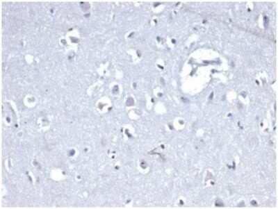 Immunohistochemistry-Paraffin: E-Cadherin Antibody (CDH1/4398R) - Azide and BSA Free [NBP3-09082]