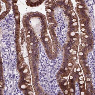 Immunohistochemistry-Paraffin: E-Cadherin Antibody (CL1170) [NBP2-34475]