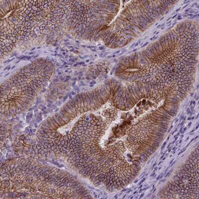 Immunohistochemistry-Paraffin: E-Cadherin Antibody (CL1170) [NBP2-34475]