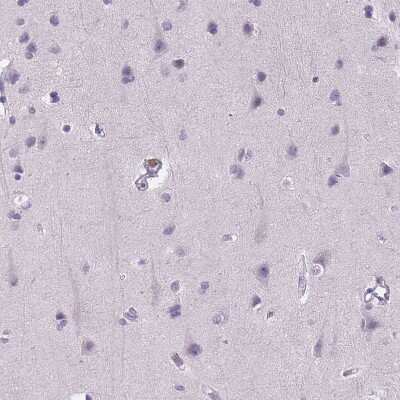 Immunohistochemistry-Paraffin: E-Cadherin Antibody (CL1170) [NBP2-34475]