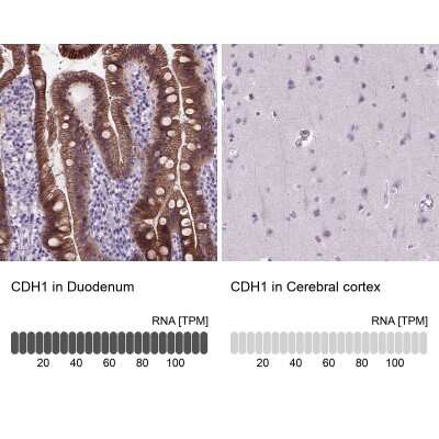 Immunohistochemistry-Paraffin: E-Cadherin Antibody (CL1170) [NBP2-34475]