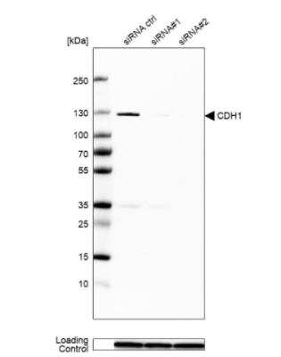 Western Blot: E-Cadherin Antibody (CL1170) [NBP2-34475]