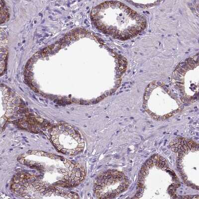Immunohistochemistry-Paraffin: E-Cadherin Antibody (CL1172) [NBP2-34476]
