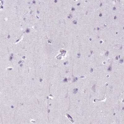 Immunohistochemistry-Paraffin: E-Cadherin Antibody (CL1172) [NBP2-34476]