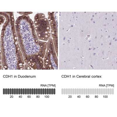 Immunohistochemistry-Paraffin: E-Cadherin Antibody (CL1172) [NBP2-34476]